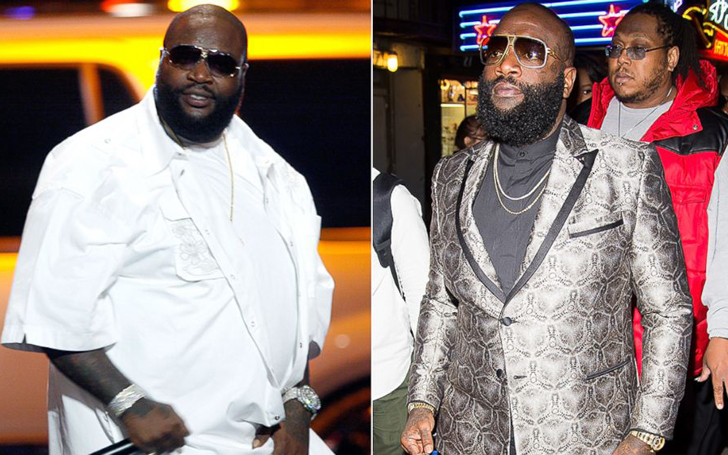 Rick Ross Weight Loss Surgery